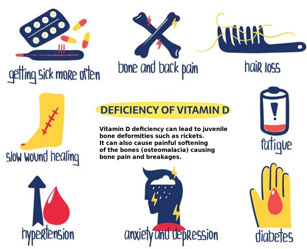 Health problems caused by Vitamin D Deficiencies